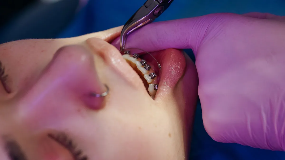 Mutuelle orthodontie enfant : ce qui est remboursé et la garantie à choisir